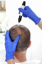 NON SURGICAL Medical Treatments and Hair Growth Solutions Photo