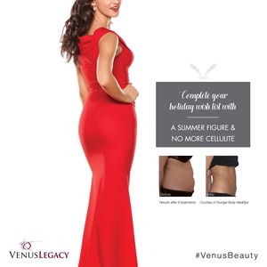 ________________________________________________________

ONE-VISIT 60 MIN BODYSCULPTING
 Photo