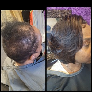 bob lace front  alopecia unit